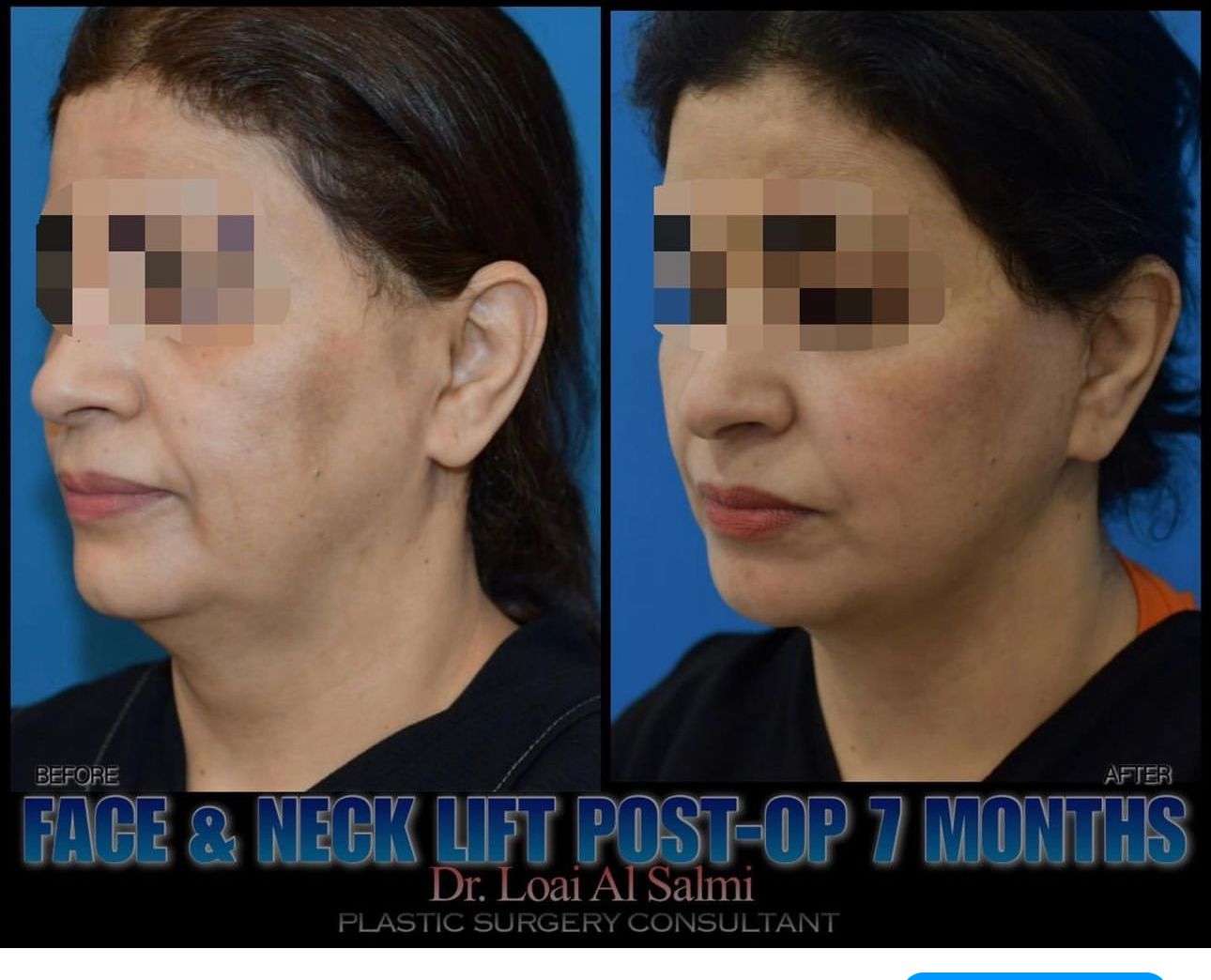 كيف تختارين أفضل جرّاح تجميل في الرياض؟ علامات الجودة والثقة قبل الحجز